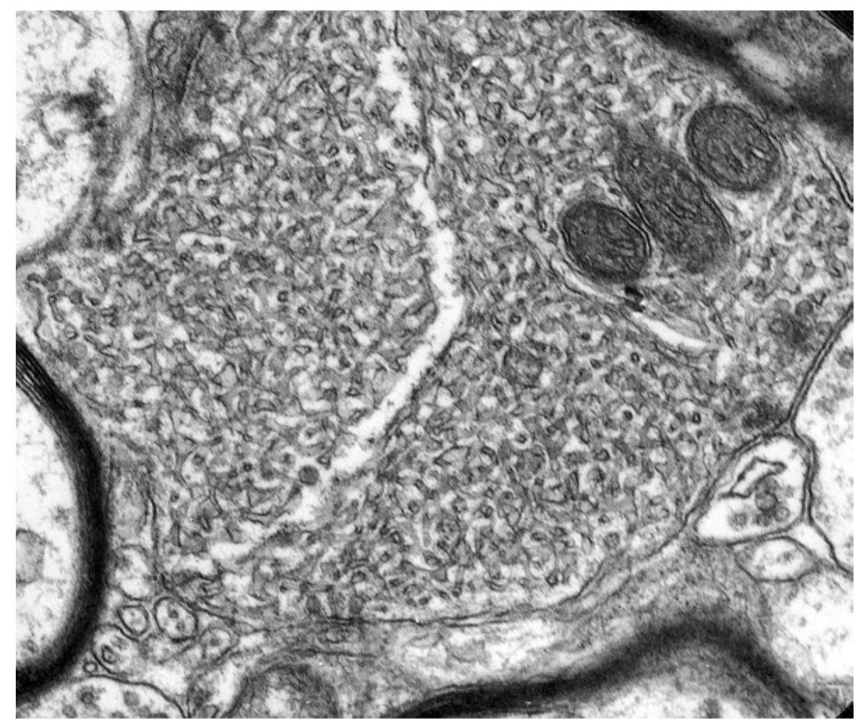 PDF) Prion Diseases Neuromethods 129