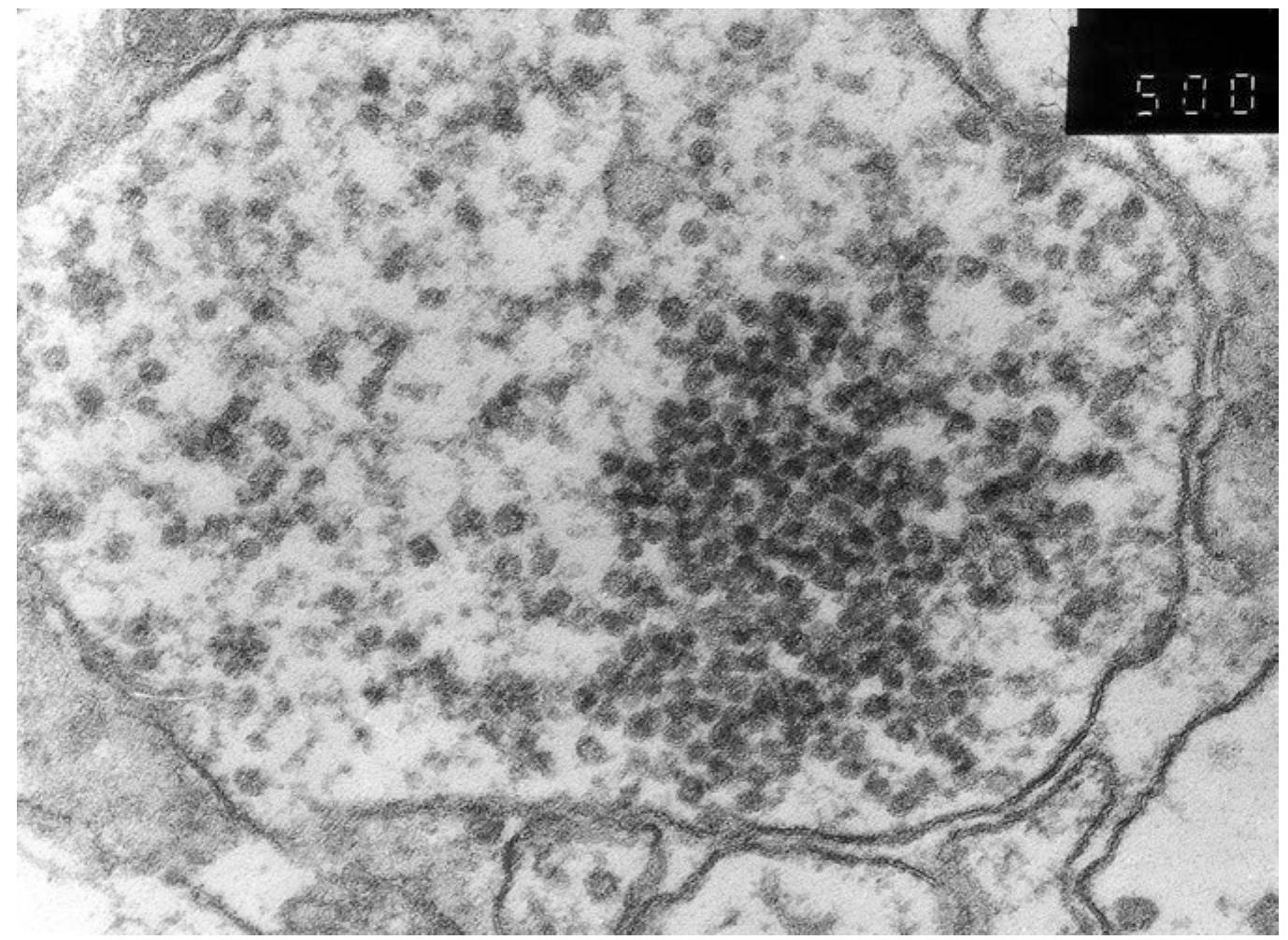 PDF) Prion Diseases Neuromethods 129