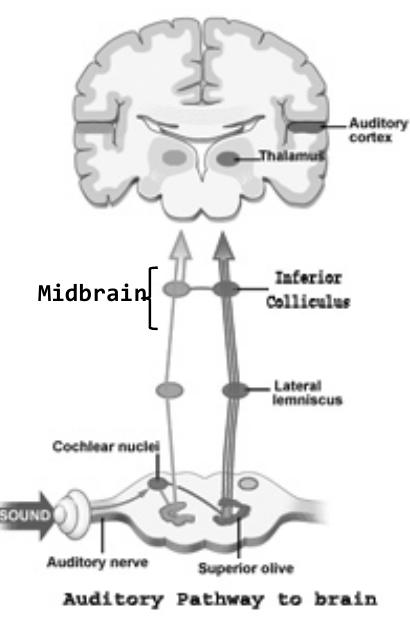 Signa Choclear Figure 3 - from 1. Cognitive development in deaf children