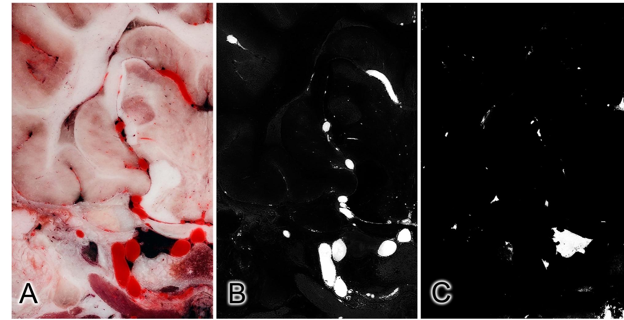 Beagle Brain (PDF) MRI, CT and high resolution macro-anatomical images with ...