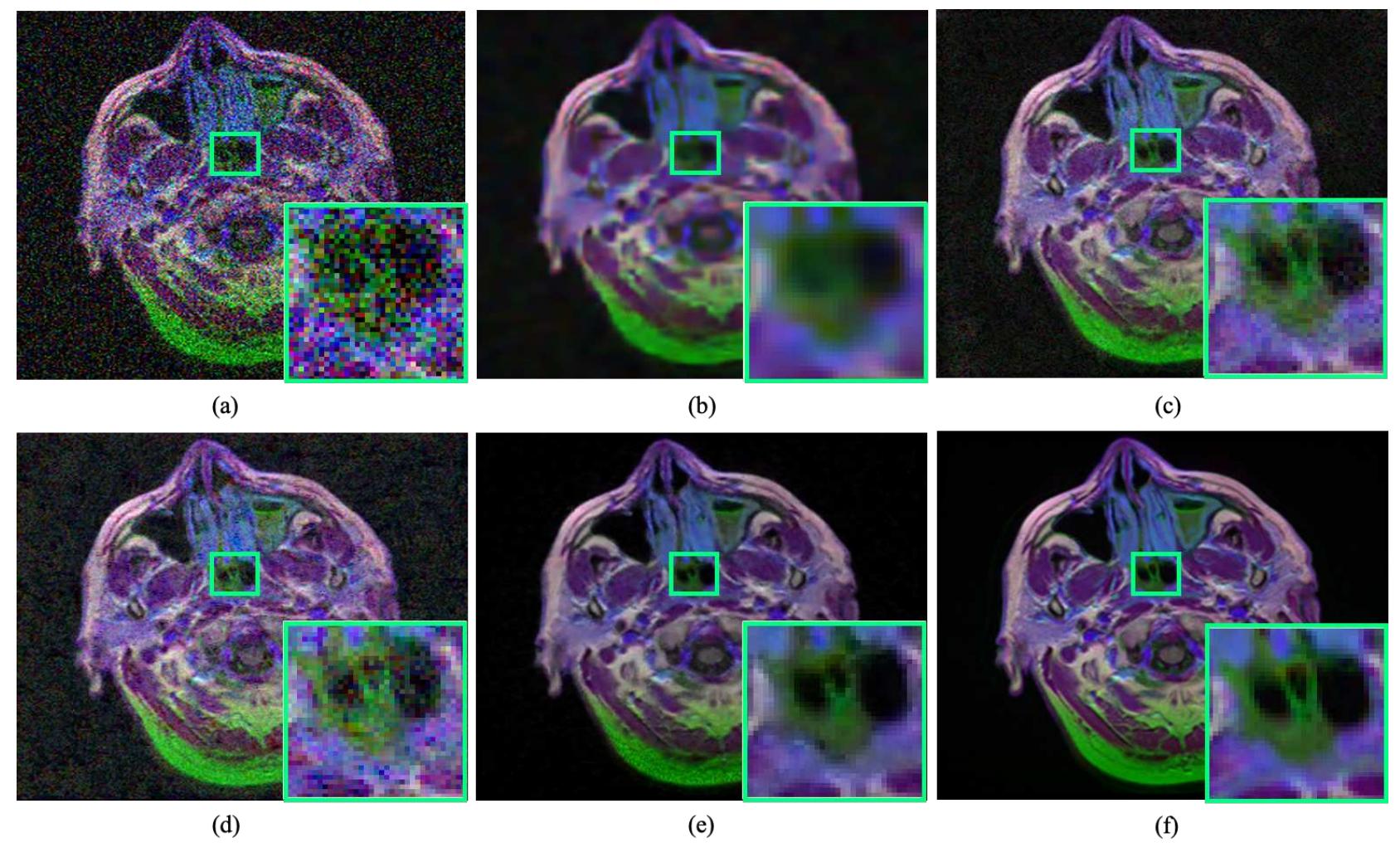 (PDF) Learning Medical Image Denoising with Deep Dynamic Residual ...