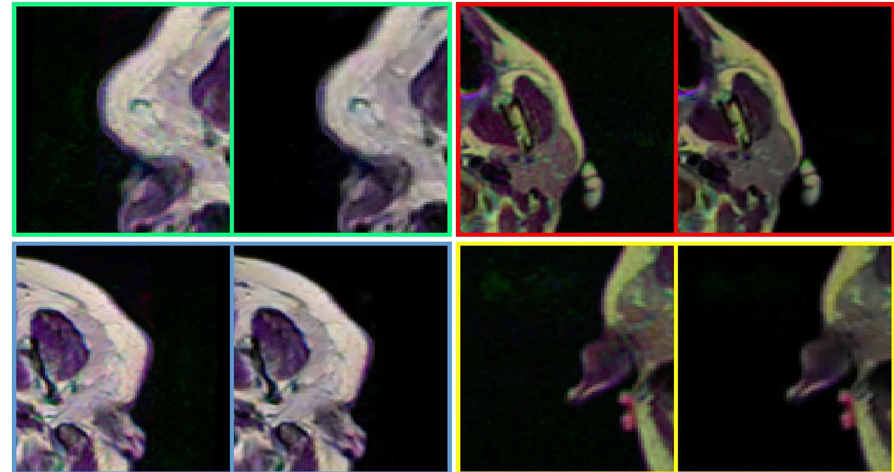 (PDF) Learning Medical Image Denoising with Deep Dynamic Residual ...
