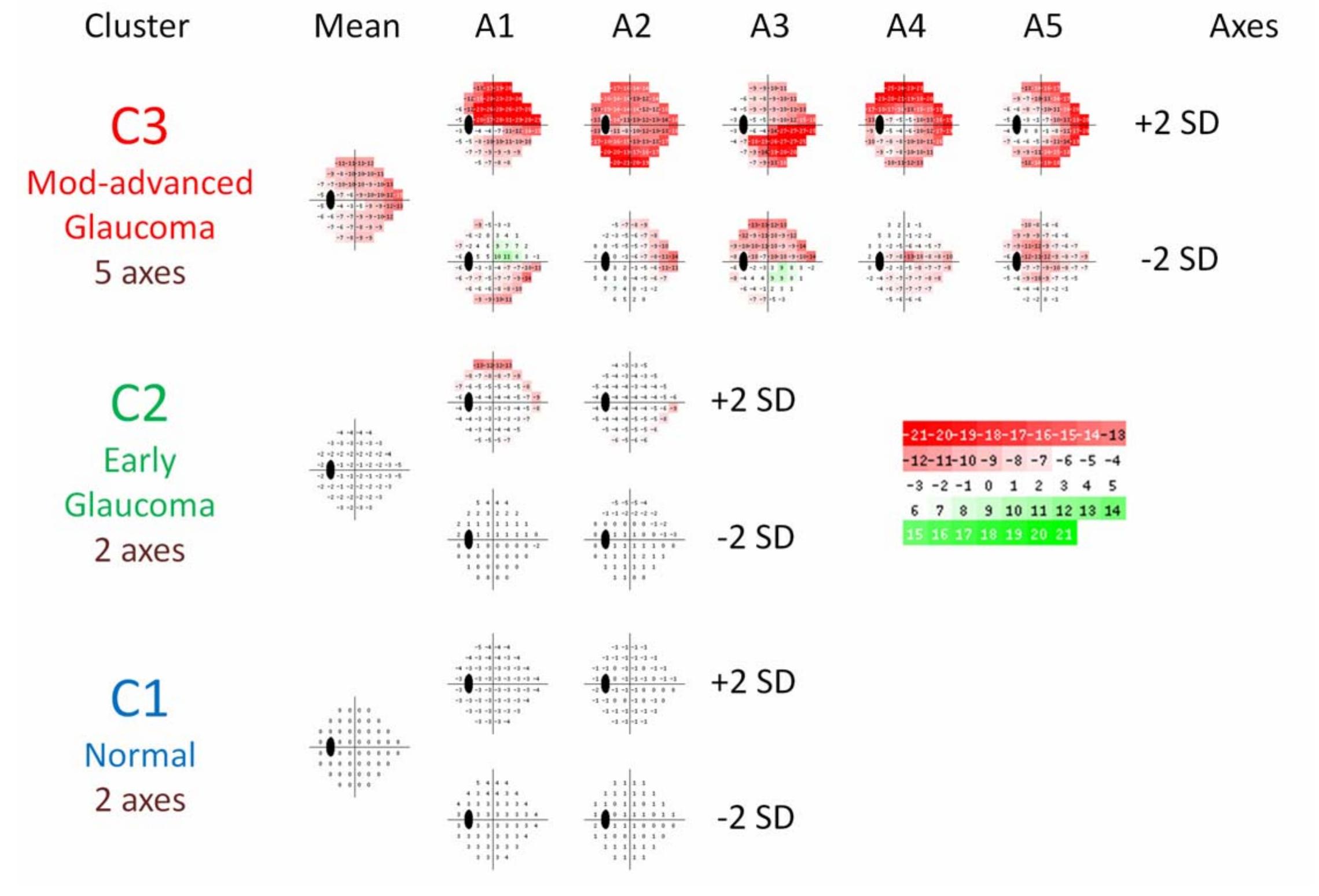 (PDF) Patterns of glaucomatous visual field loss in sita fields ...