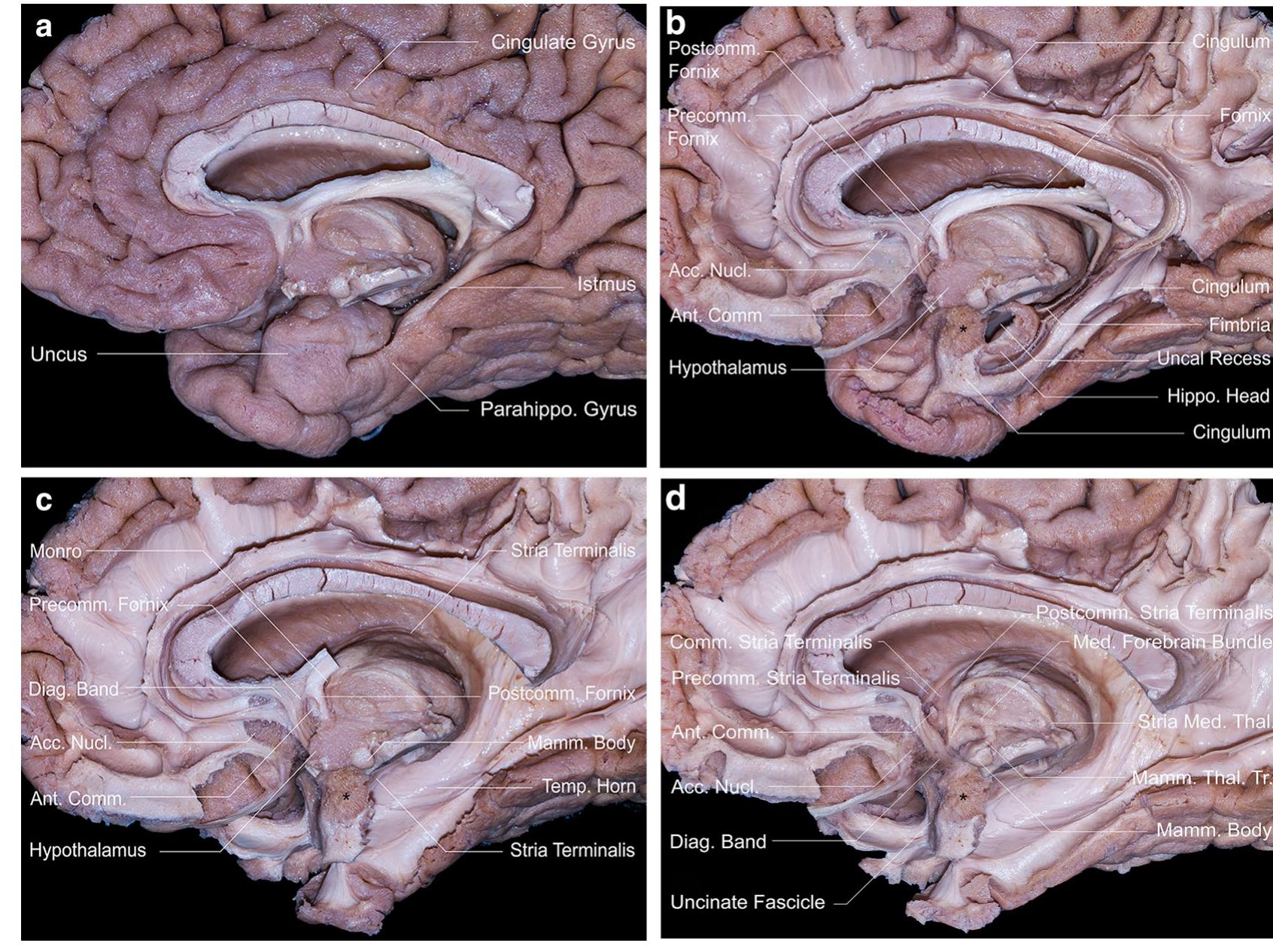 (PDF) Brain Structure and Function Microsurgical anatomy of the ...