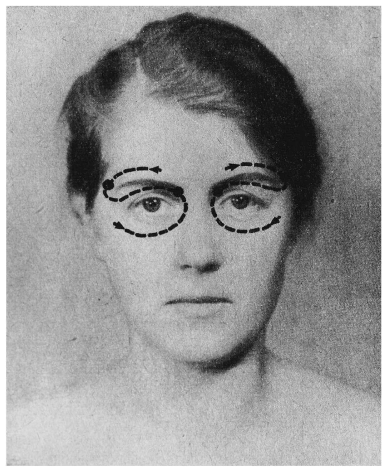 stares Back—there is a certain repose in my way of looking.'? (In that book, I used these 