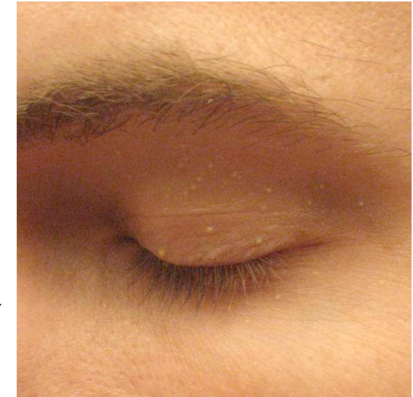 text or a mark of the soul? If I say a rash is psychosomatic, I betray how poorly I have thought out 