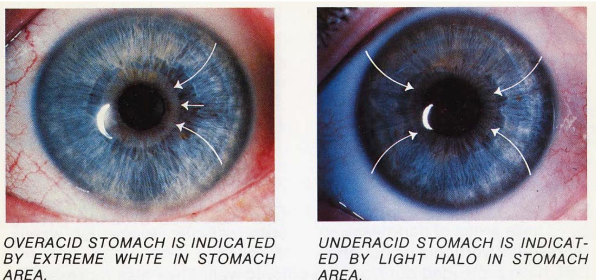iris, continues to be popular. (The illustration here is from Iridology Simplified, by Bernard  study of lines in the forehead.’ Iridology, the diagnosis of ailments by study of the patterns of the 