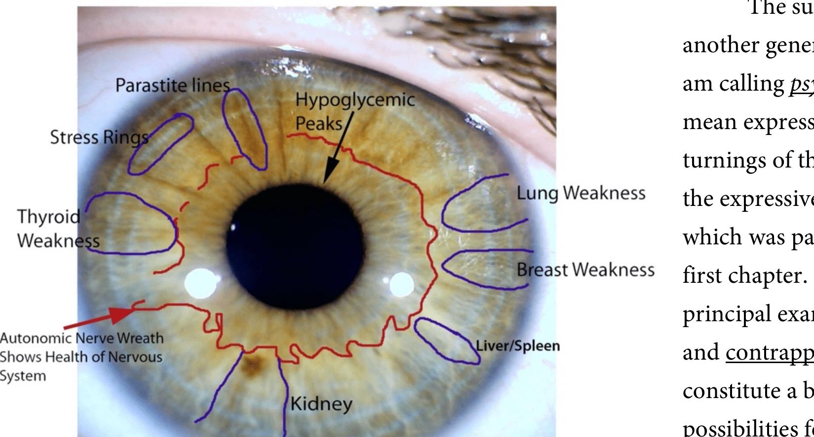ind positions of the depicted body. Physiognomy is an attempt at a semiotics of the face, and  ontrapposto is a language of bodily motion. Deleuze marks the difference by calling the face ; faciality machine,” capable only of generating facial effects, but I would hesitate to make a cle ut division, because there are so many other ways of reading the body that depend on divisio: vithin the body or the face.’ The existence of practices such as metoposcopy, which does not  ipprehend the face as a single visual or linguistic field, shows the limitations of a general (and argely non-visual) account such as Deleuze’s. Palmistry reads some lines, and metoposcopy a lermatoglyphics read others, and none of them depends on the distinction between a “facialit  nachine” and other mechanisms of meaning.  C4e:11 «4. £2. ne on ct th nln tn nLbt ne naw nwt, Lene. th, (ho nw A] nnn ne Le wn nny kK.) ne JD th. 