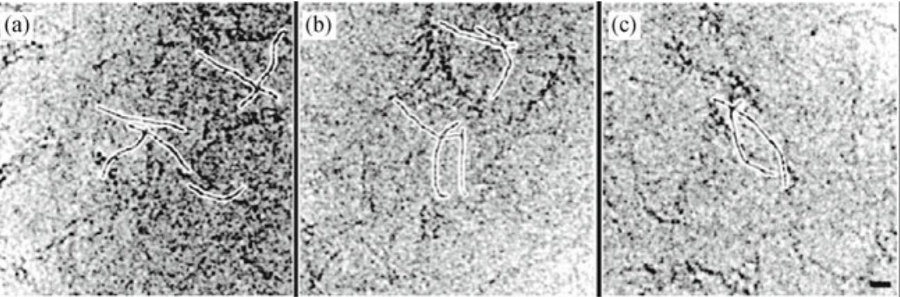 27 gallery of cryo-negative stained desmin tetramers. the