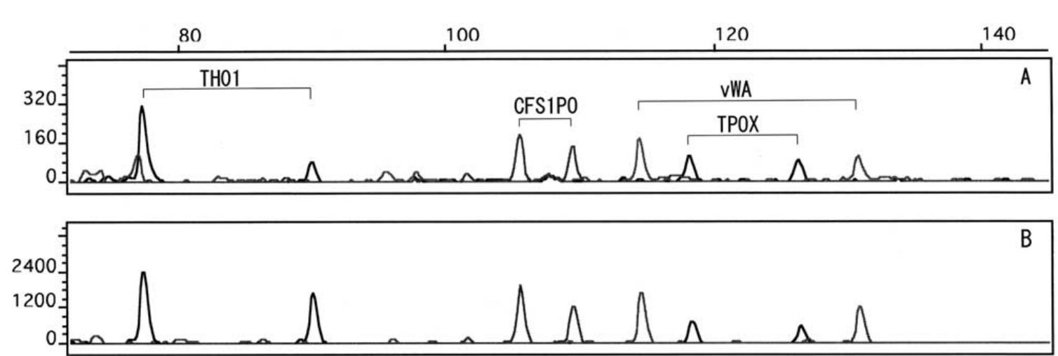 Th01 (PDF) Multiplex short tandem repeat typing in degraded samples using ...