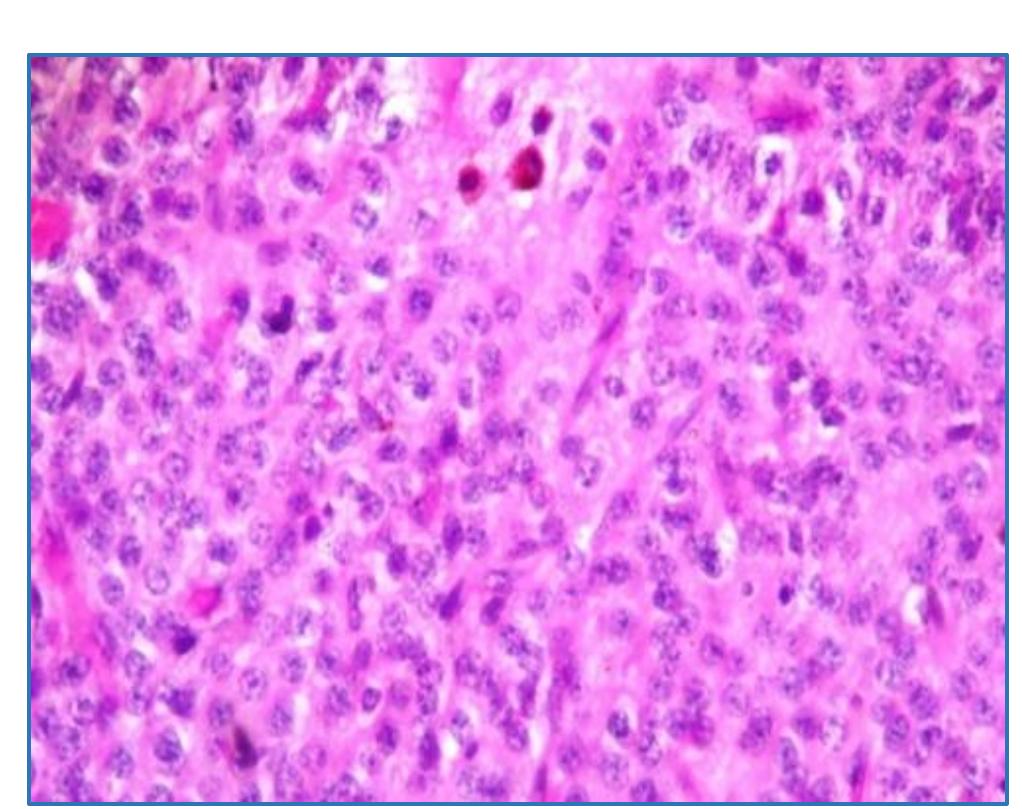 Picture 2. hpe showing homogenous cells separated by