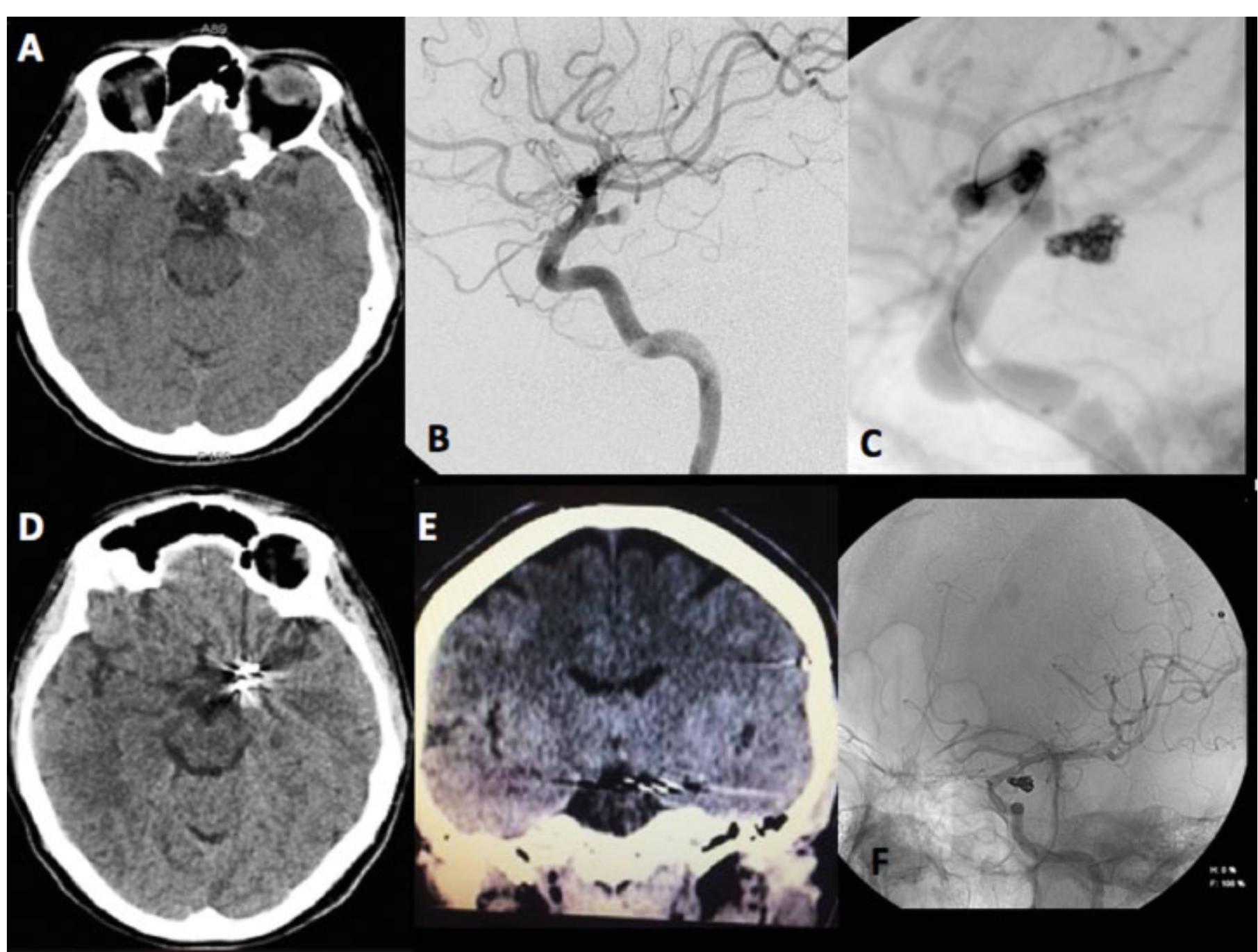 Case 1 - 54-year-old female patient.