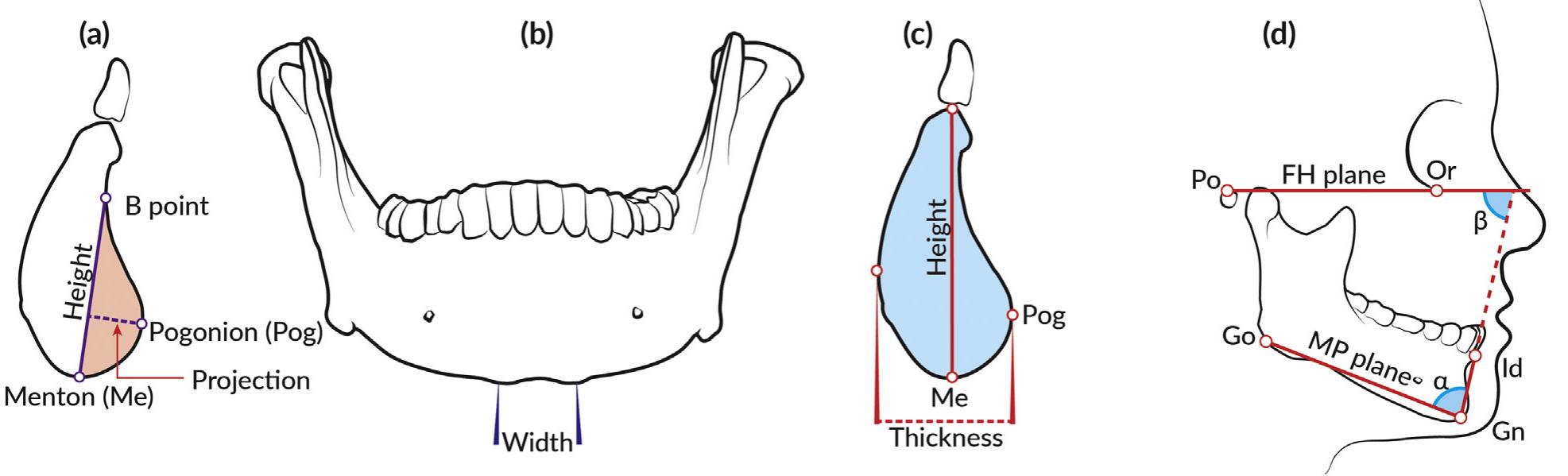 Figure 3 - from Are chin and symphysis morphology facial