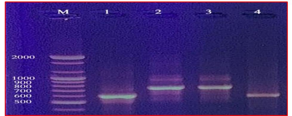 2% agarose gel electrophoresis analysis for pcr products of