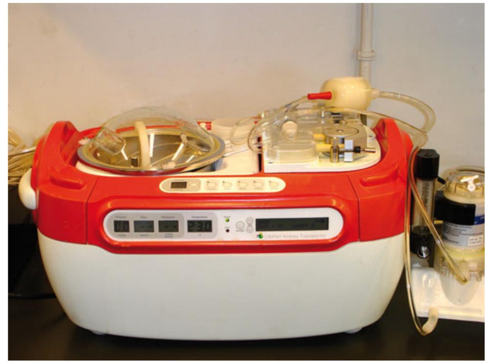 Portable perfusion pump. the heartport© system is a modified