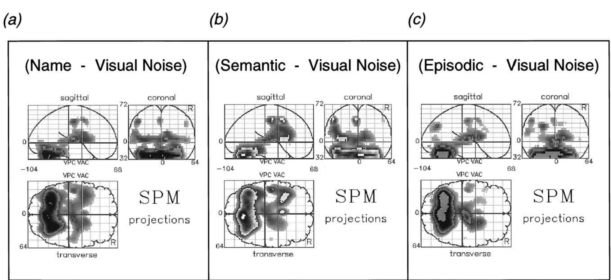 Figure 2 - from Neural correlates of semantic and episodic