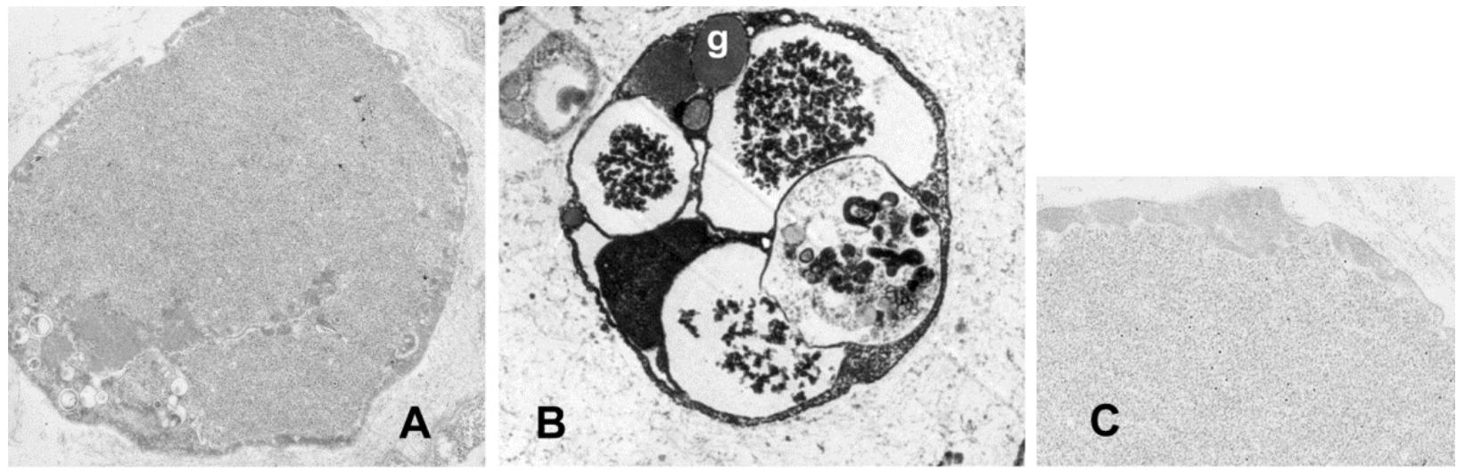 prince「sign \"o\" the times」LP PDF) In Vitro antimicrobial properties of coriander