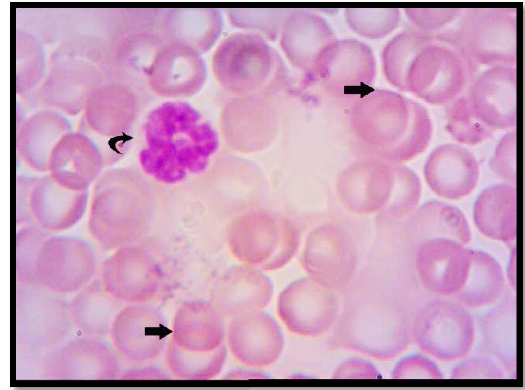 (4) explains the blood smear of the exposed mice group c.
