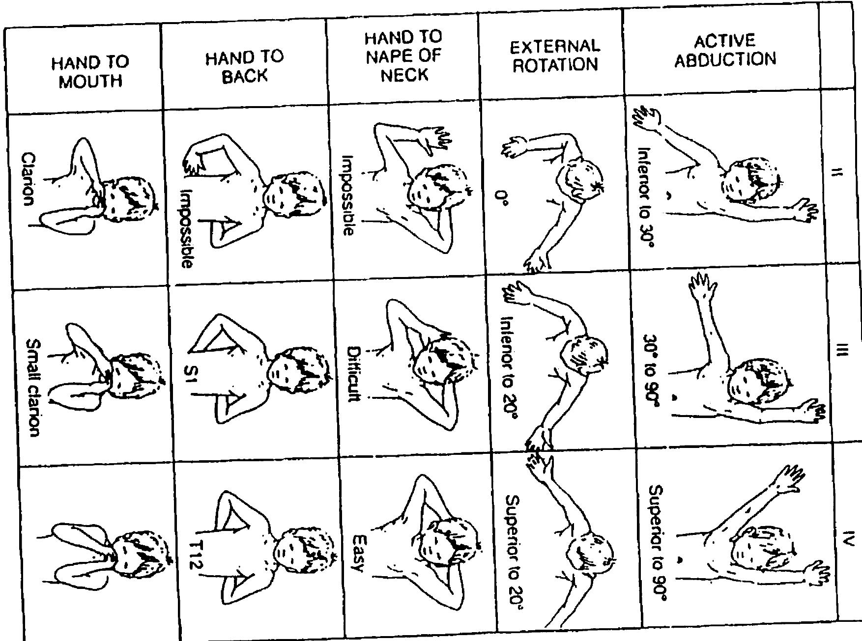 Figure 2 - from The active movement scale: An evaluative