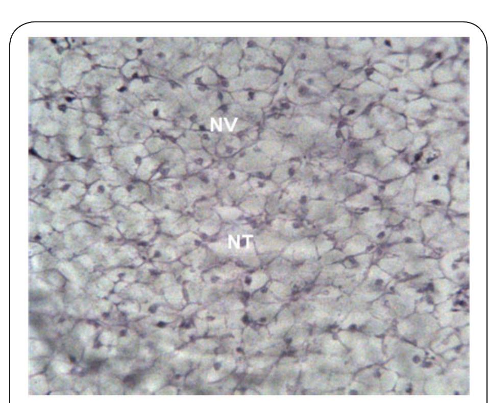 Plate 2. Photomicrograph of Liver of Clarias gariepinus prior to exposure at x400. NV and NT indicate the normal tissue vacuoles and normal tissue hepatocytes respectively. 