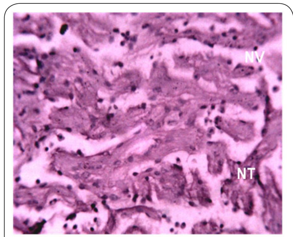 Plate 1. Photomicrograph of Kidney of Clarias gariepinus prior to exposure at. NV and NT indicate the normal tissue vacuoles and normal tissue cells respectively. 