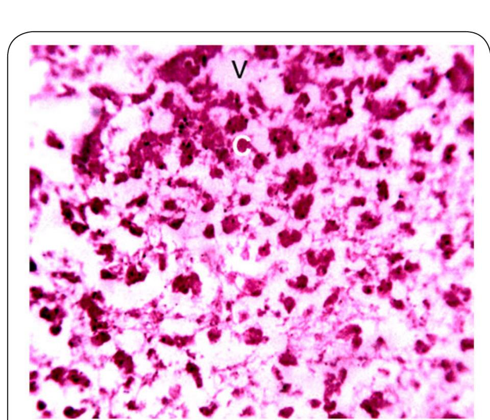 Plate 4. Photomicrograph of Liver of Clarias gariepinus obtained from Station 1 after 14 days bio-assay in River Galma at x400. The letter V indicates vacoulation of the tissue. The letter C indicates constriction, hypertrophy and aggregation of hepatocytes. 