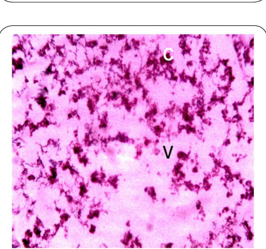 Plate 6. Photomicrograph of Liver of Clarias gariepinus obtained from Station 2 after 14 days bio-assay in River Galma at x 400. The letter V indicates severe vacoulation and necrosis of the tissue. The letter C indicates constric- tion, hypertrophy and aggregation of hepatocytes. 