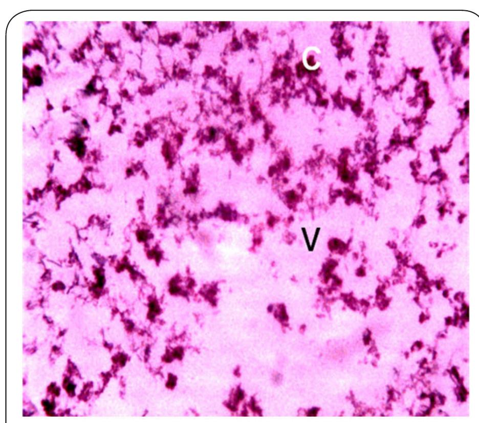 Plate 7. Photomicrograph of Kidney of Clarias gariepinu obtained from Station 3 after 14 days bio-assay in River Galma at X 400.The letter V indicates severe shattering, vacoulation and necrosis of the tissue. The letter C indi- cates constriction, hypertrophy and aggregation of cells. 