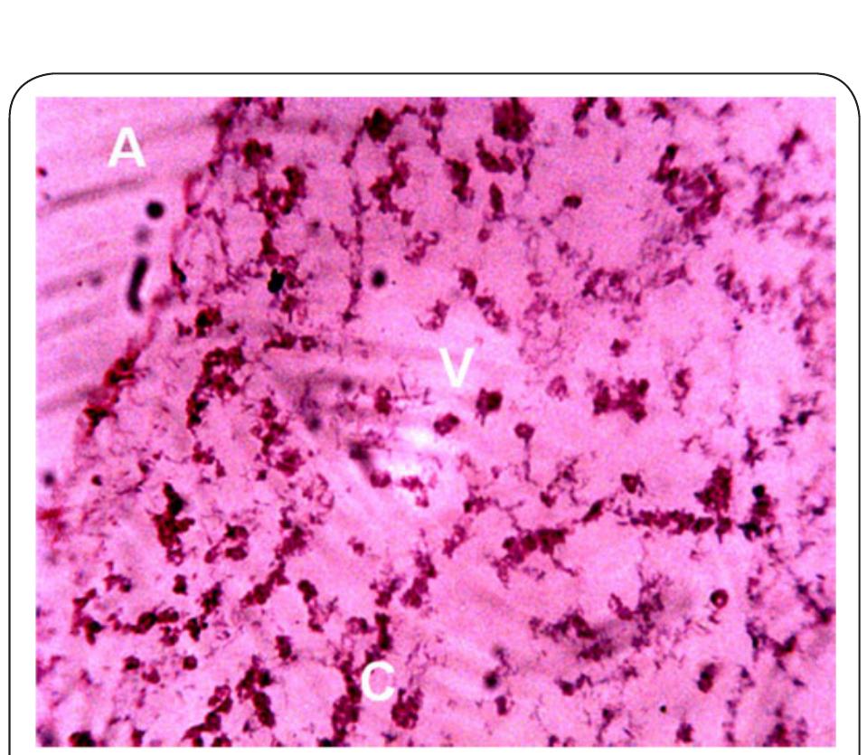 Plate 8. Photomicrograph of Liver of Clarias gariepinus obtained from Station 3 after 14 days bio-assay in River Galma at x 400. The letter V indicates vacoulation of the tissue. The letter C indicates constriction and aggregation of hepatocytes. 