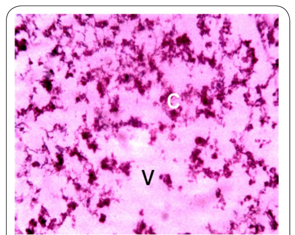 Plate 9. Photomicrograh of Kidney of Clarias gariepinus obtained from Station 4 after 14 days bio-assay in River Galma at x 400. The letter V indicates severe shattering and vacoulation of the tissue. The letter C indicates constriction, hypertrophy and aggregation of cells. 