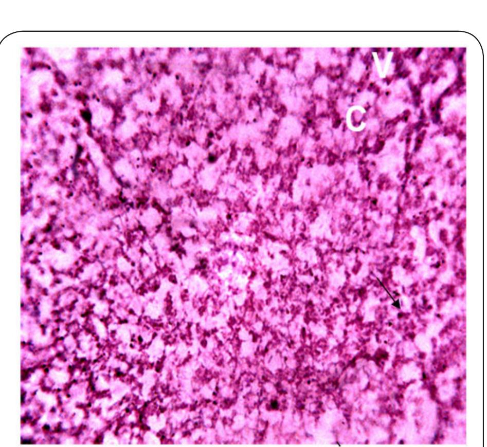 Plate 10. Photomicrograph of Liver of Clarias gariepinus obtained from Station 4 after 14 days bio-assay in River Galma at x 400. The letter V indicates vacoulation of the tissue. (C) Indicates constriction and aggregation of cells.  