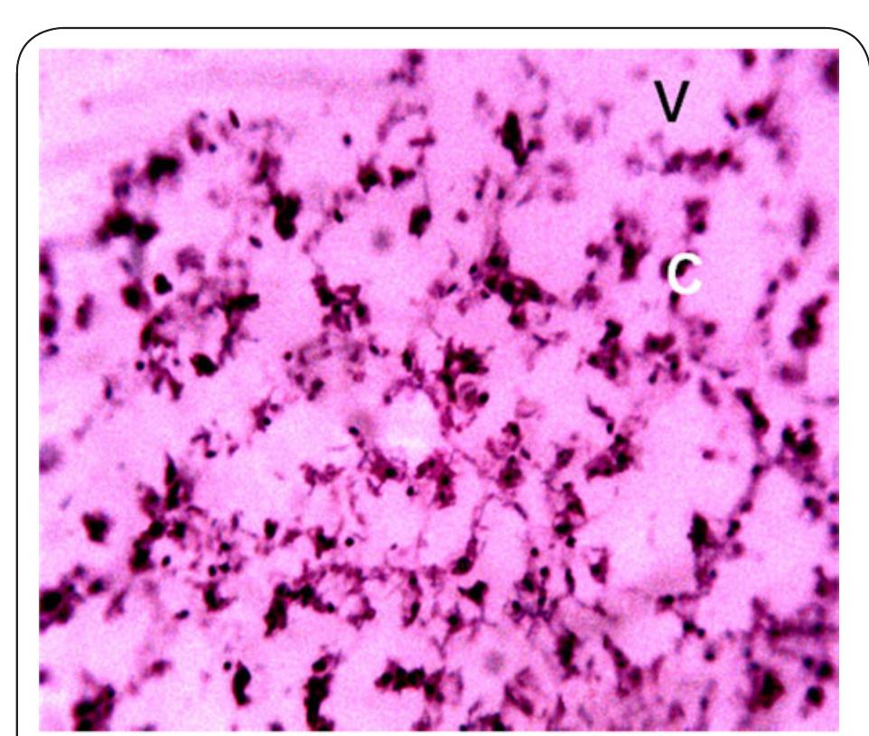 Plate 11. Photomicrograph of Kidney of Clarias gariepinus obtained from Station 5 after 14 days bio- assay in River Galma at 400. The letter V indicates severe shattering and vacoulation of the tissue. The letter C indicates severe constriction, hypertrophy and aggregation of cells. 