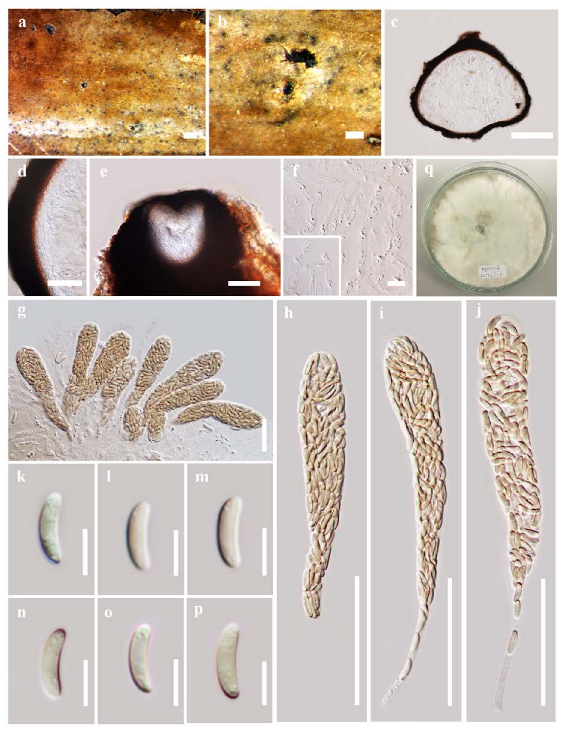 Allanoid Yellow, thick-walled cells of textura angularis. hamathecium