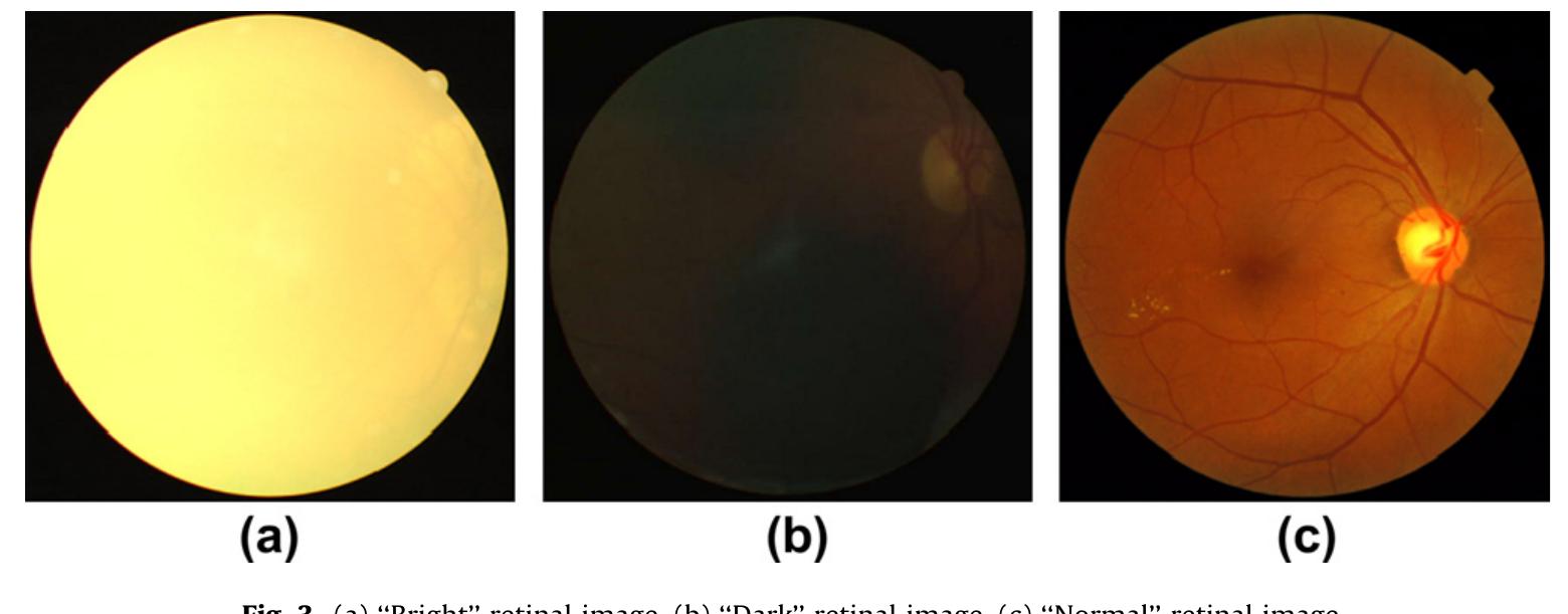 (PDF) Retinal image quality assessment using generic image quality ...