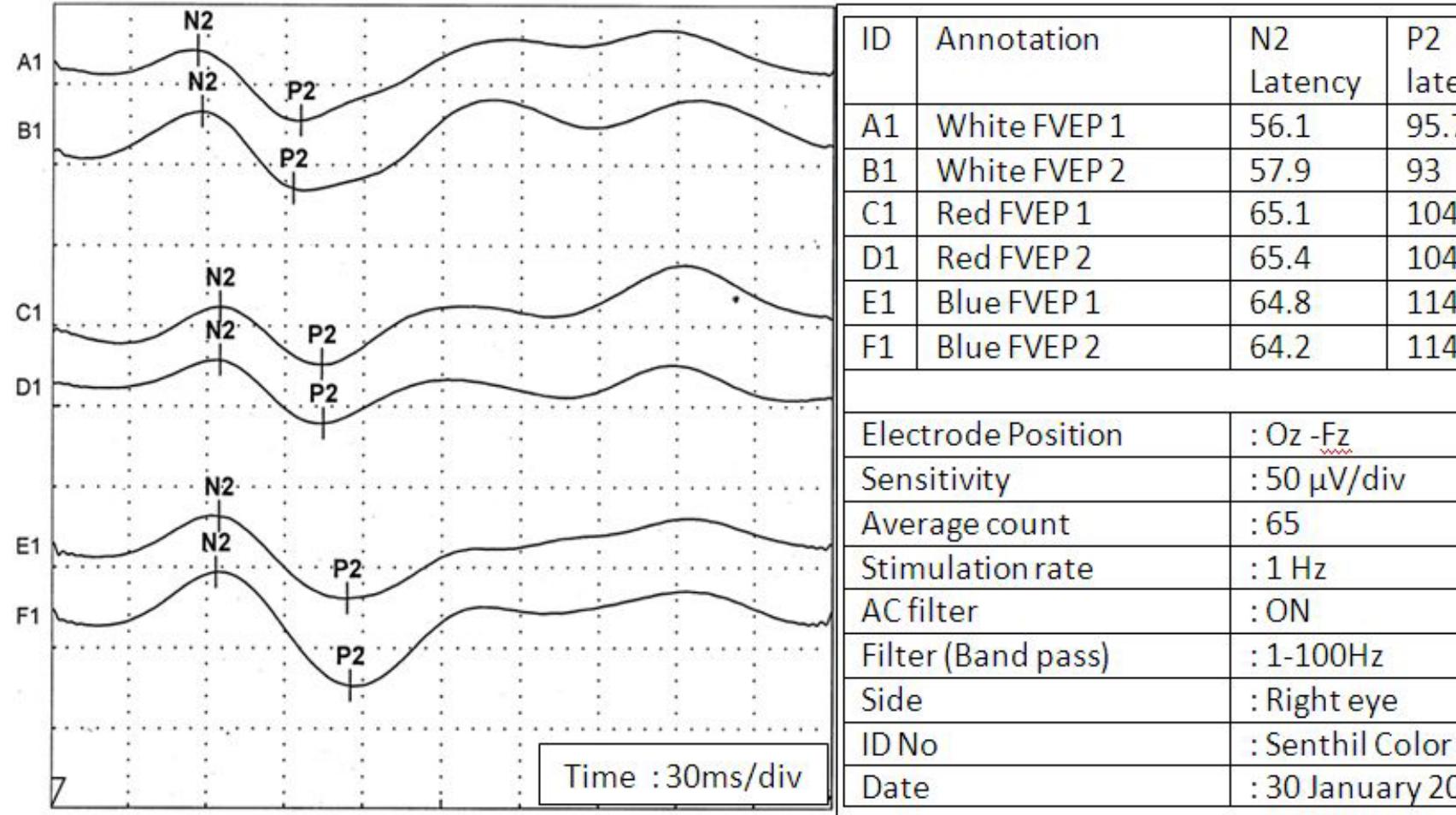 (PDF) Effect of color of flash stimulus on variability of flash visual ...