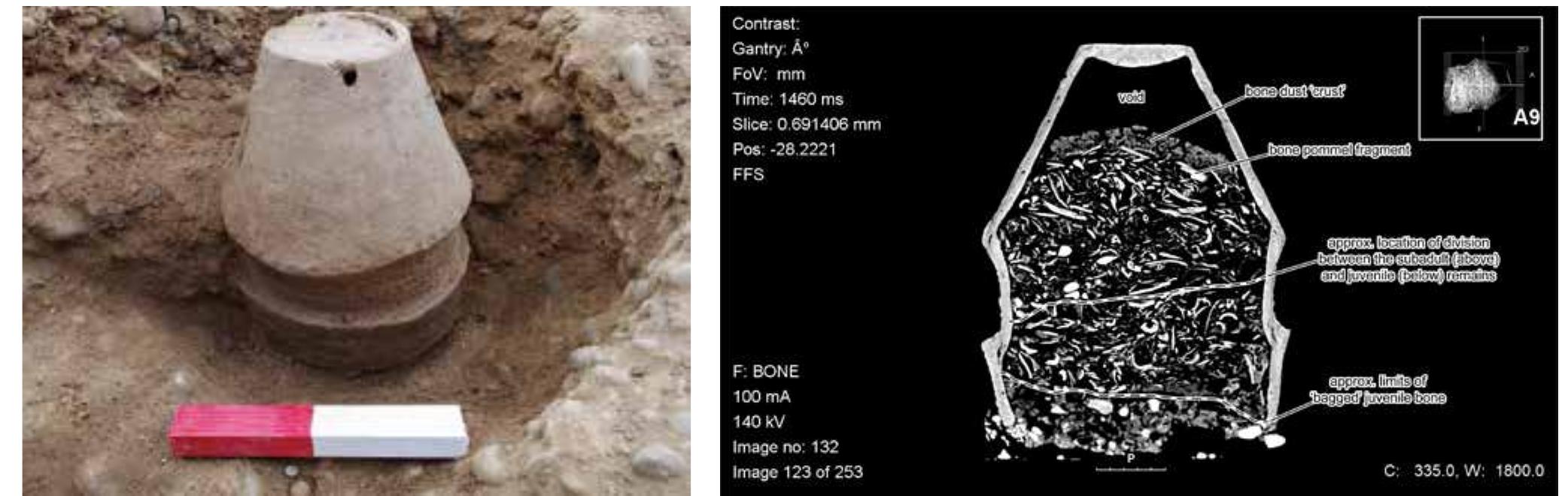 Left: collared urn in situ during excavation. right: