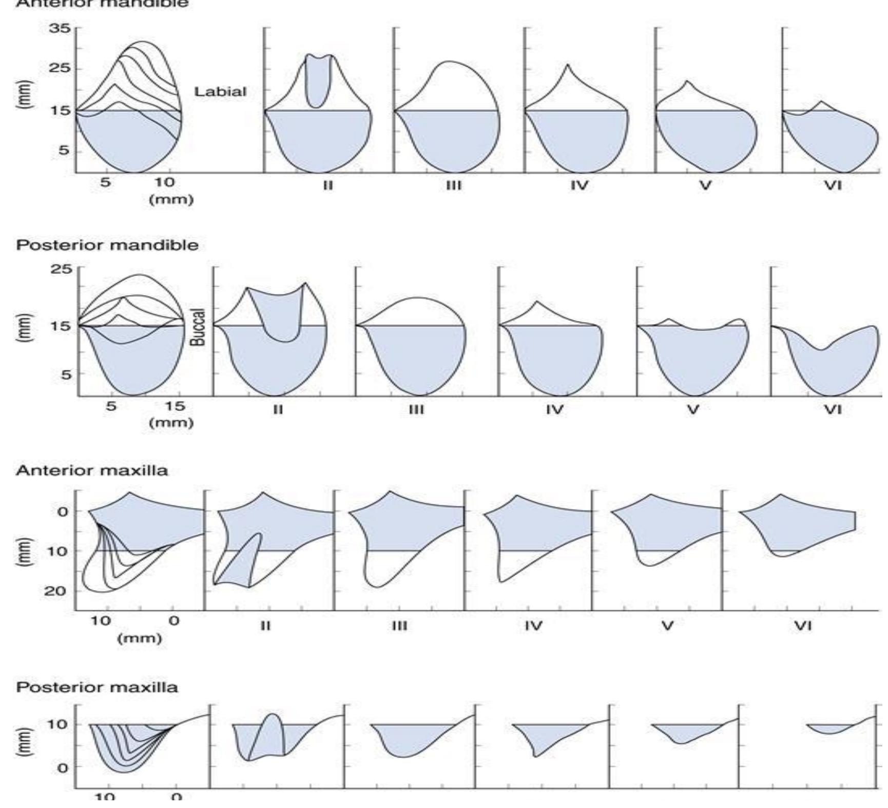(PDF) Residual Ridge Resorption A Challenge To Conquer: A Review