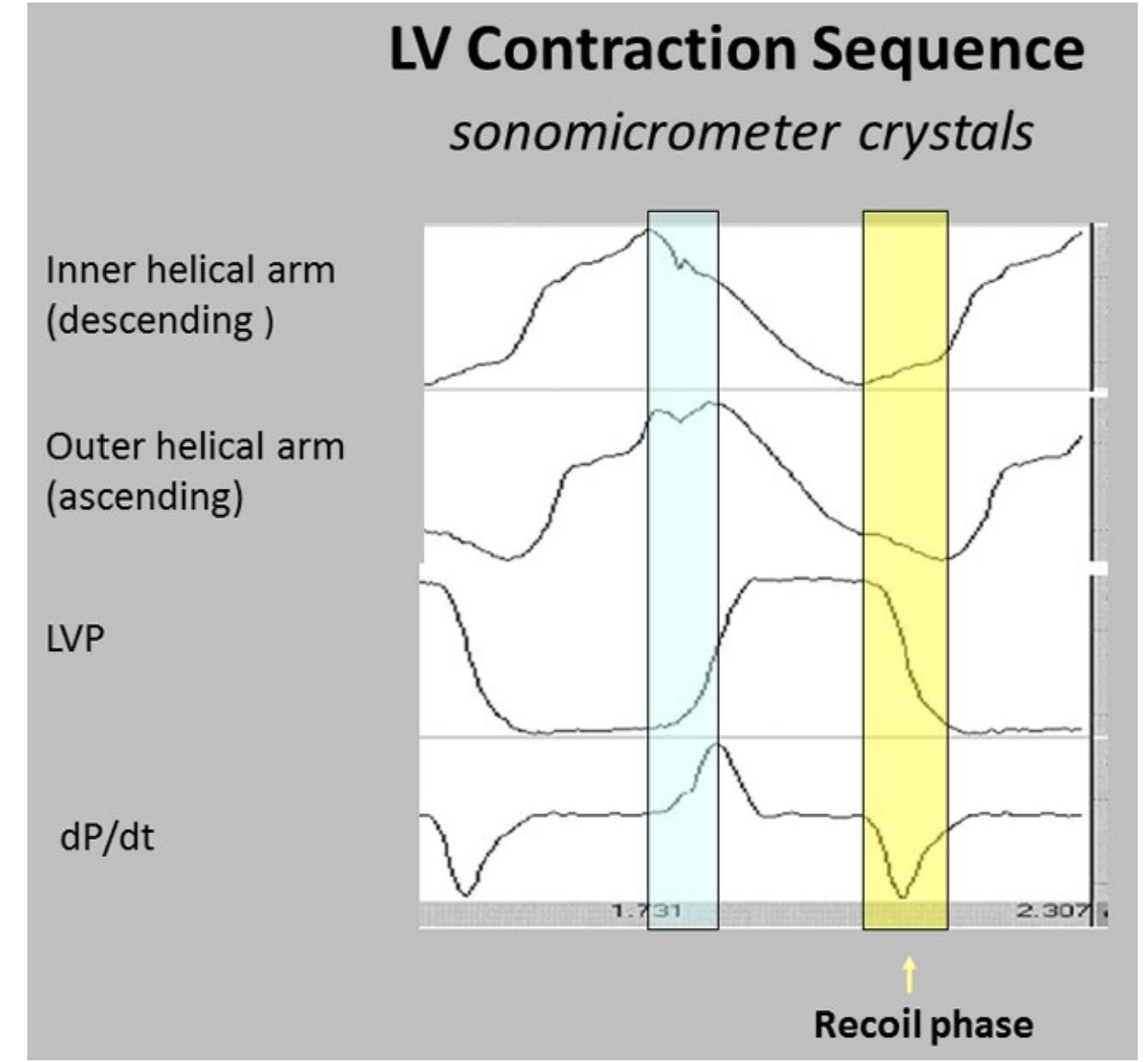 Left ventricular contraction sequence by anterior lv