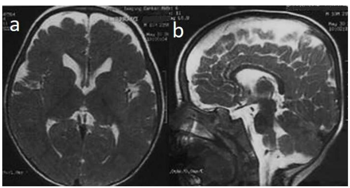 a ers figure 1. axial (a) and sagittal (b) view of brain