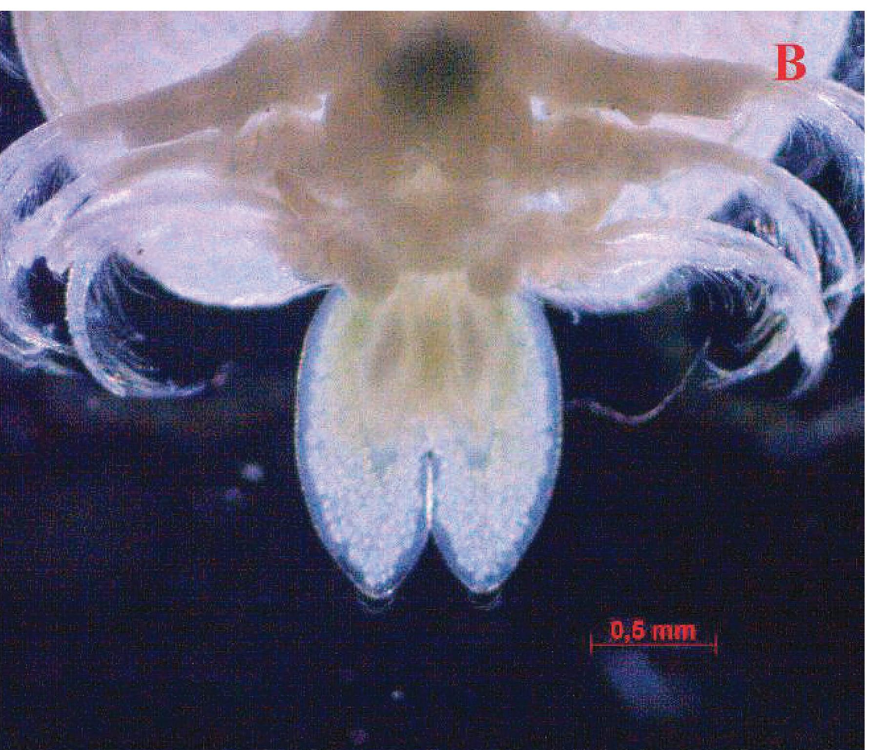 (PDF) A Study of Fish Lice (Argulus Sp.) Infection in Freshwater Food Fish