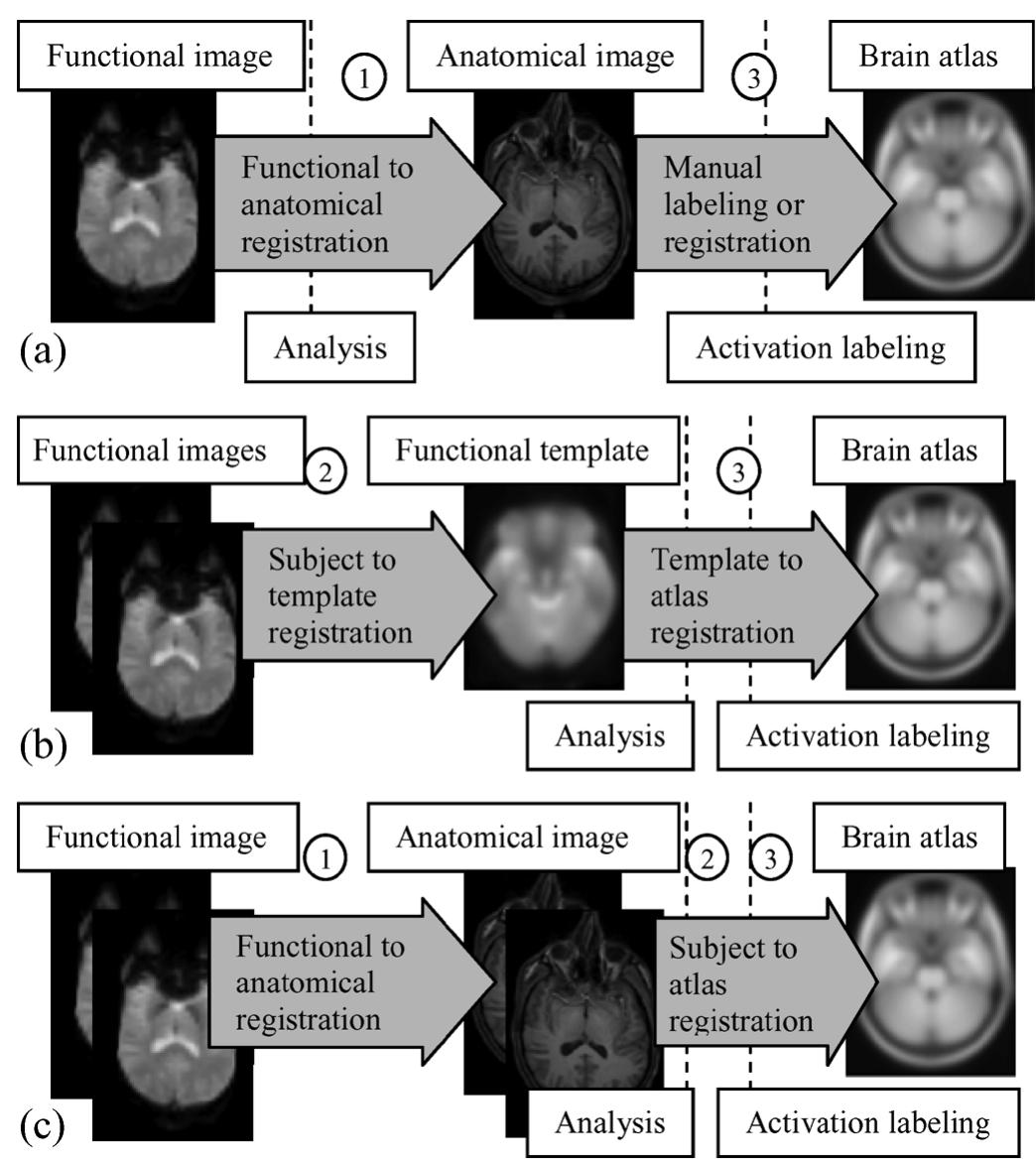 (PDF) Brain Functional Localization: A Survey of Image Registration ...