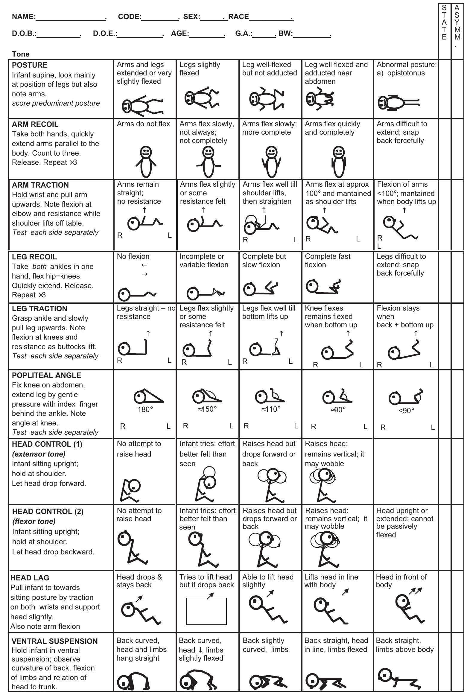 Figure 2 - The neurological examination of the newborn baby