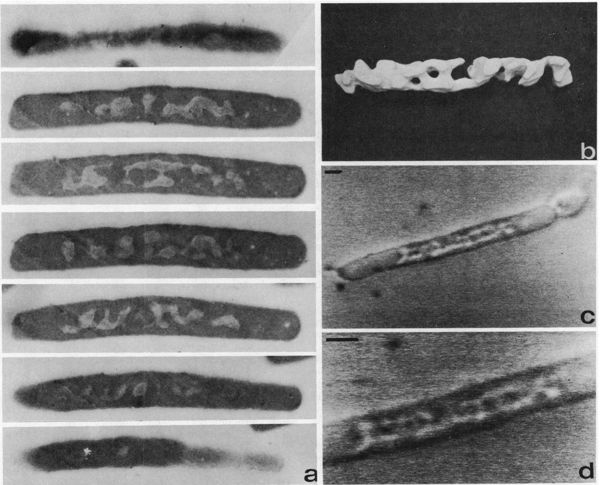 (PDF) Confocal scanning light microscopy of the Escherichia coli ...