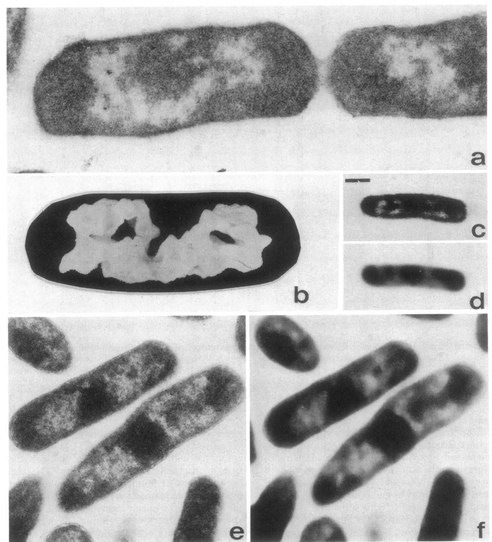 (PDF) Confocal scanning light microscopy of the Escherichia coli ...