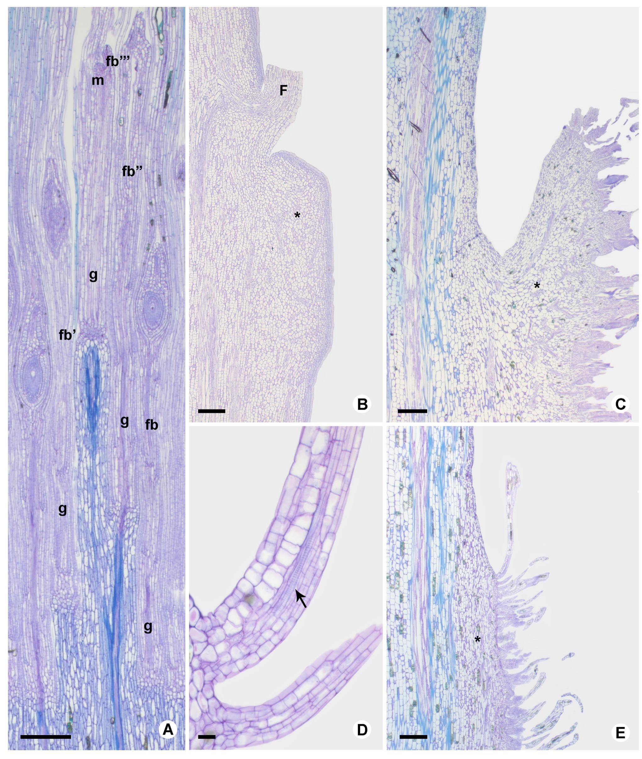 Figure 5 - Synflorescence morphology of species of Typha L.