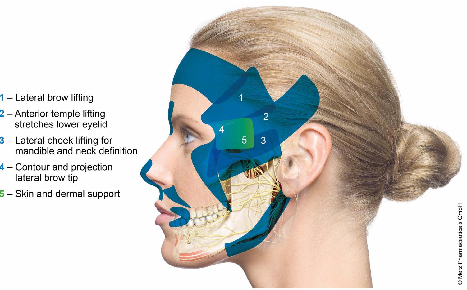 Image shows the left side of a male body donor after the
