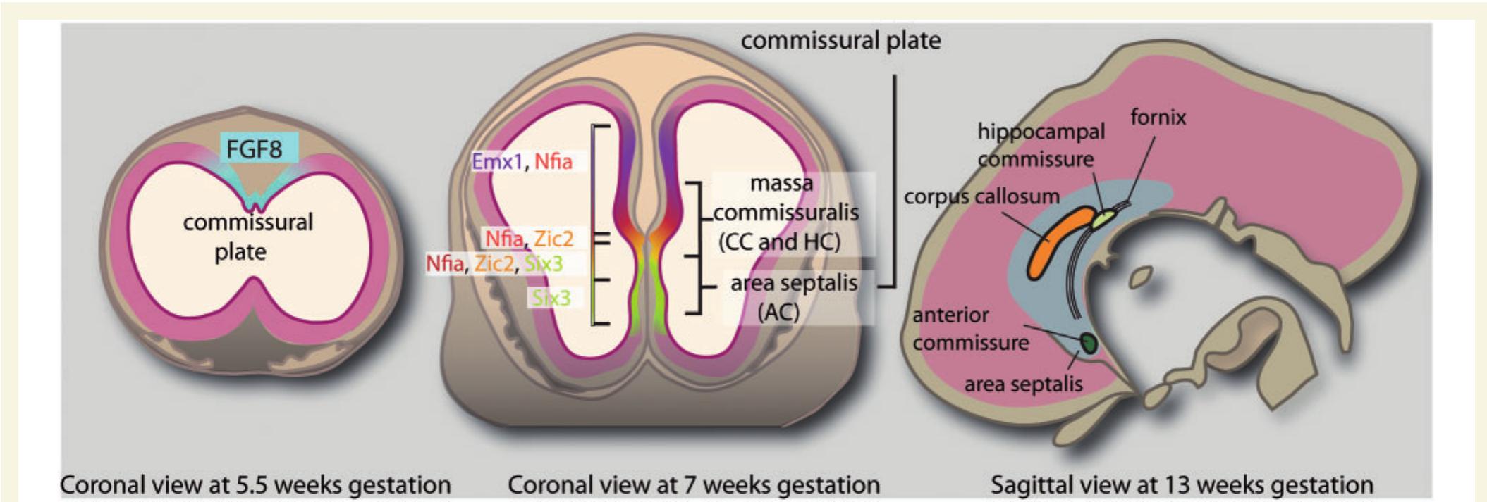 Figure 1 - from Clinical, genetic and imaging findings