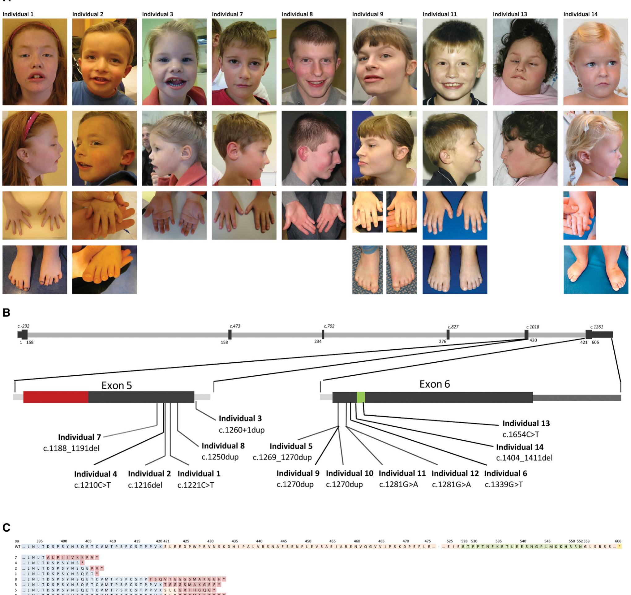 (PDF) De Novo Truncating Mutations in the Last and Penultimate Exons of ...