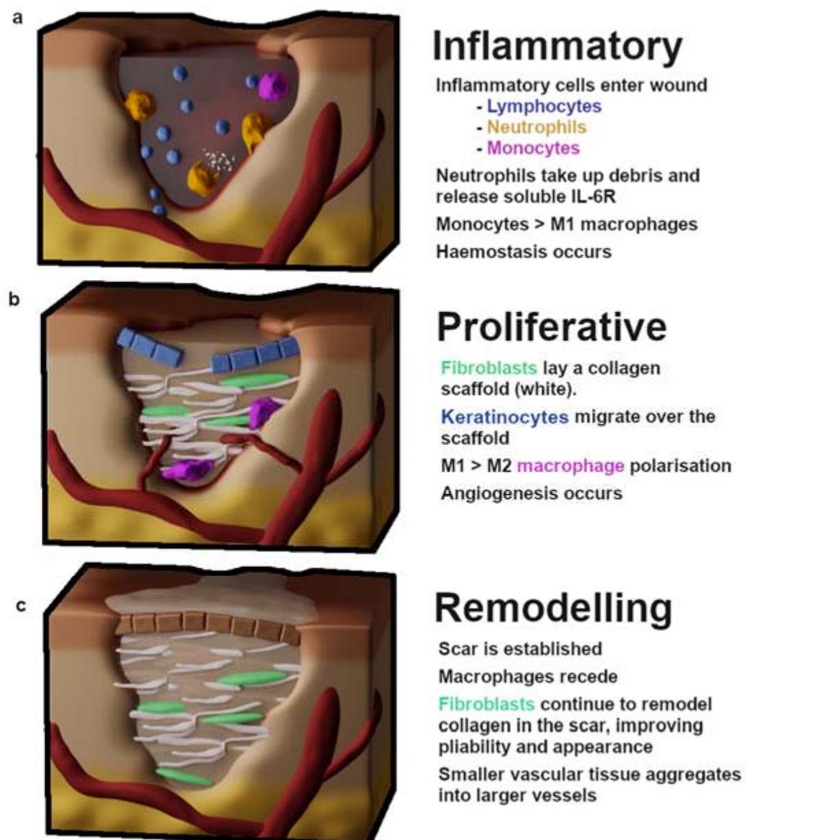 Figure 1 - from The Role of IL-6 in Skin Fibrosis and