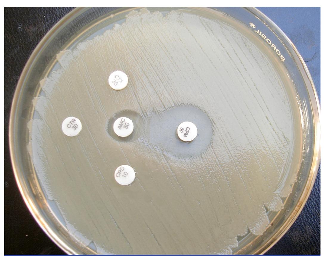 (PDF) Modified Double Disc Synergy Test to Detect ESBL Production in ...